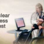 Lexiscan Stress Test: Meaning of Lexiscan, Side Effects, Reasons, Instrument.