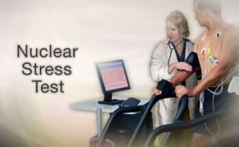 Lexiscan stress test