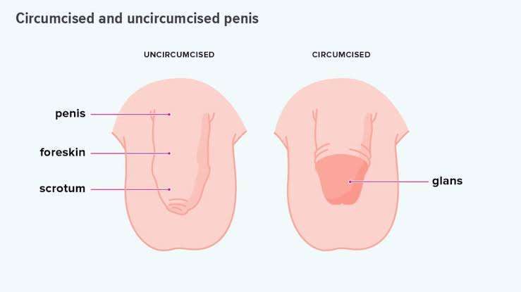 Disadvantages of having sex with an uncircumcised man